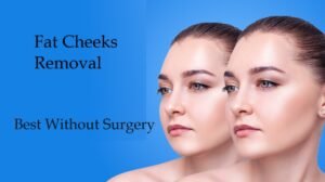 Fat Cheeks Removal