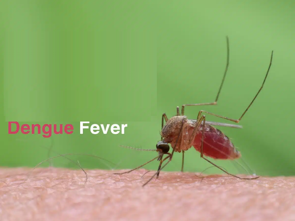 How does a person get dengue fever?